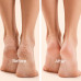 Furr Foot Peeling Mask 1 Nos