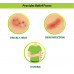 Tetmosol Dusting Powder 100 gm 